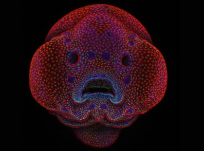 تصویر میکروسکوپی از جنین چهار روزه گورخر ماهی ( ماهی زبرا )