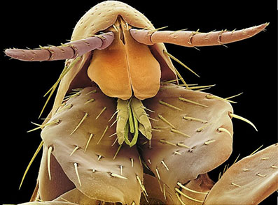 تصویر میکروسکوپی از کک انسانHuman flea (Pulex irritans)