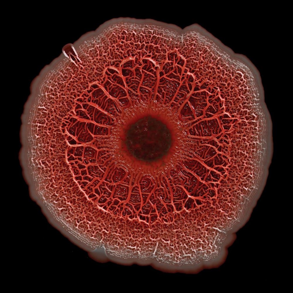 تصویر میکروسکوپی از بیوفیلم یا کلنی باکتری‌های خطرناک پسودوموناس ایروژینوزا  ( Pseudomonas aeruginosa )