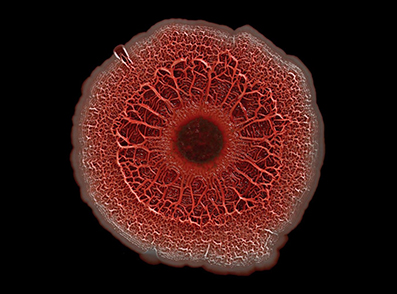 تصویر میکروسکوپی از بیوفیلم یا کلنی باکتری‌های خطرناک پسودوموناس ایروژینوزا