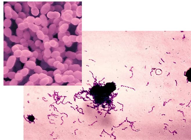 تصویر میکروسکوپی از باکتری استرپتوکوک موتانس ( Streptococcus mutans)، مهمترین عامل پوسیدگی و کرم‌خوردگی دندان
