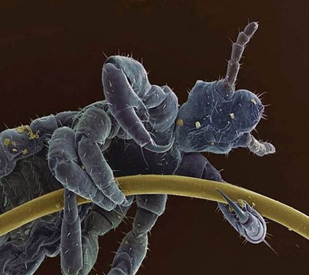 تصویر میکروسکوپی از شپش سر چسبیده به تار موی انسان