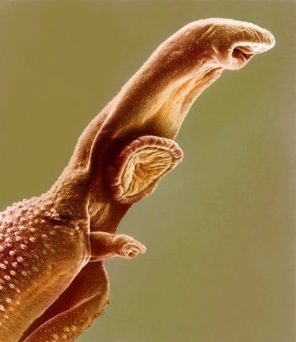 تصویر میکروسکوپی ازترماتود شیستوزوما که بوسیله بادکش‌های عضلانی وفنجان مانند خود به میزبان می‌چسبد. بادکش دهانی در انتهای قدامی و بادکش شکمی ( استابولوم بزرگتر ) در قسمت خلفی بادکش دهانی دیده می‌شود.