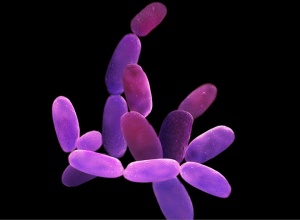 تصویر میکروسکوپی از هالوباکتریوم ( ( Halobacterium، میکروارگانیسم نمک دوست و میله‌ای شکل