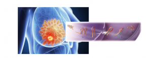 بررسی اثرات نوعی micro RNAدر بافت‌های توموری پستان